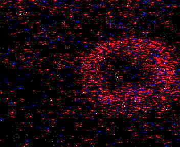 Evan's Third Flare [enhanced]